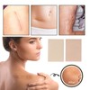 100pcs Tattoo Cover Up Patch Scar Concealer Sticker Set Invisible