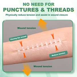 Large Steri Wound Closure Strips, Butterfly Bandaids, Emergency Wound Closure Device Surgical Laceration Repair Without Stitches for Big Wound Care, Hospital Grade Rapid Skin Closure for Home, Outdoor