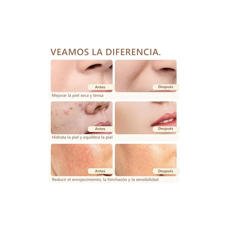 Crema Cebo Res Balsamo Miel Sebo Cara Facial Acabado Pasto