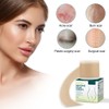 3 Meters Silicone Scar Stickers to Reduce Itching and Redness