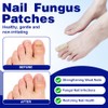 ADDLIVE 42 Stück Pilz-Nagel-Patches, Fungal Nail Patches, Nagelpilz Pflaster, Zehennagel