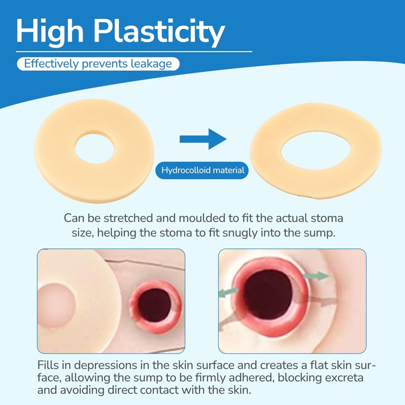 Heagimed 10Pcs 2mm Moldable Ostomy Rings, Hydrocolloid Stoma Barrier Rings