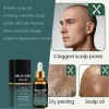 Crema Hidratante Hialurónica Para Cuero Cabelludo Bald Care