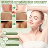 Cress Ointment, Active Cress Ointment Against Age Spots, Active Cress