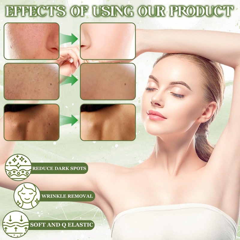 Cress Ointment, Active Cress Ointment Against Age Spots, Active Cress