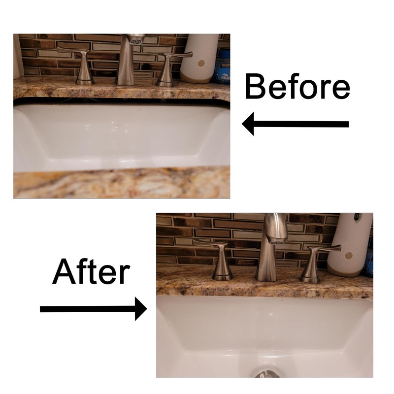 Undermount Sink Brackets,Undermount Sink Clips, Sink Repair Kit,Repair Dropped Sink,