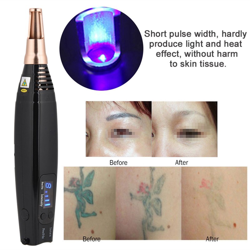Blue Light Picosecond Pen Scar Tattoo Removal Pen For Melanin