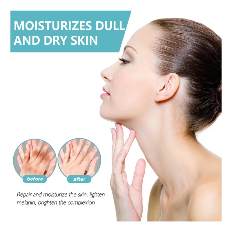 Fixderma Nigrifix Crema Para Acantosis Nigricans Fbg