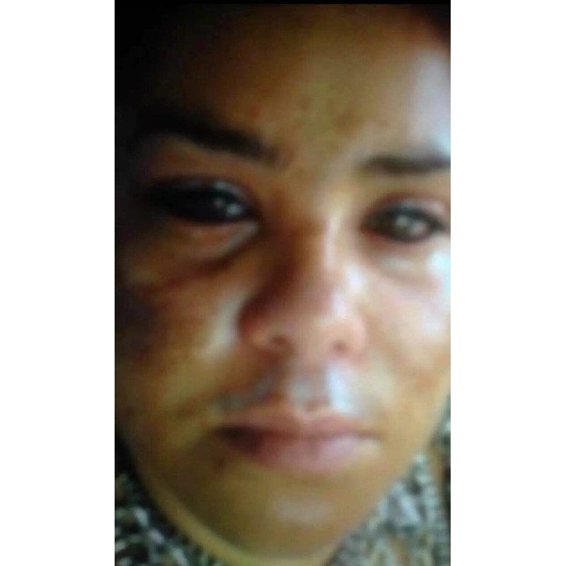 SAMMY DAY CREAM: TE MANTIENE LA PIEL LIBRE DE MANCHAS