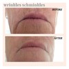 Wrinkles Schminkles Mouth and Lip Wrinkle Patch - 1 Patch