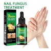 Lápiz Líquido Reparador De Uñas, Tratamiento Para Hongos En