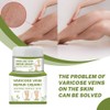 Varicose Veins Cream Natural Ointment for Varicose and Spider Veins