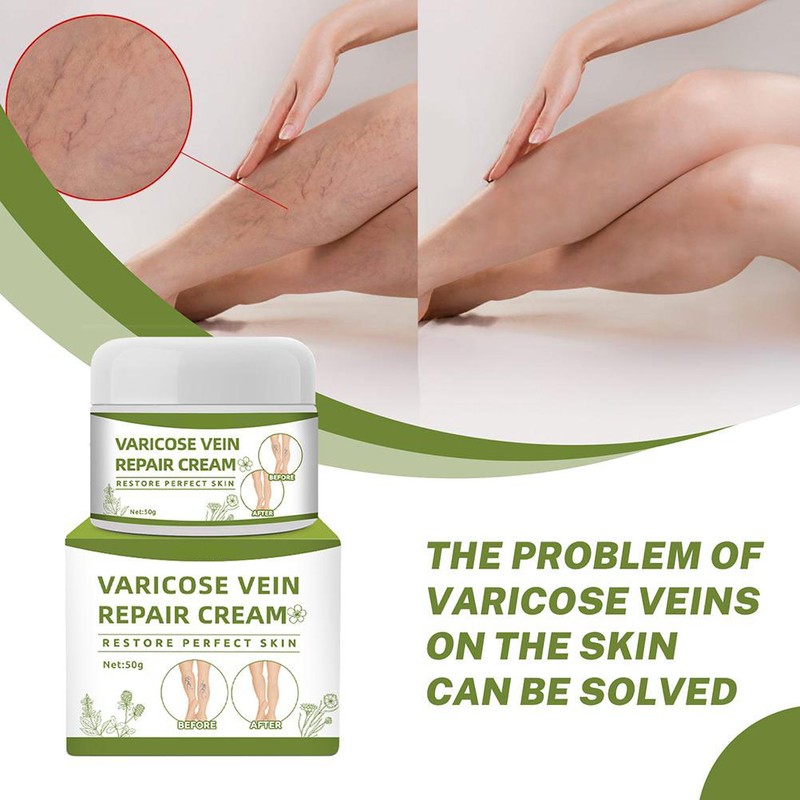 Varicose Veins Cream Natural Ointment for Varicose and Spider Veins