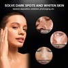 Khangura - Anti Spot Serum, Anti-aging, Anti-wrinkle, Reduce Pigmentation, Dark