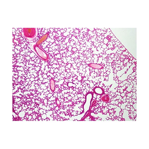 Prepared Slide, Lung, Classpack of 15 Sides