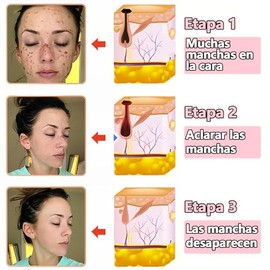 2 Pack Gel exfoliante purificanteExfoliating Scrub Gel for Face and BodyElimina Suavemente las Células Muertas, Hidrata y Unifica el Tono para una... 