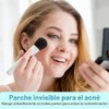 180 Pcs Parches para Granos, Parches Granos Estrella, Con Aceite