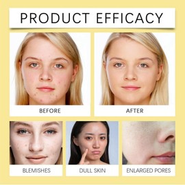 Deep Cleansing Moisturizing Facial Exfoliator,Facial Cleanser Oil For All Skin Types,Facial Cleanser Cleansing Oil,Korean Cleanser,Purifying Face Cleanser, Moisturizing Brightening Cleansing Milk