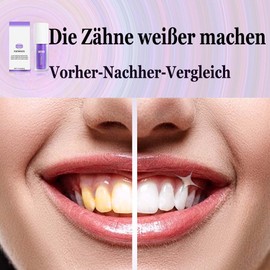 Lila Zahnpasta für Zahnaufhellung-Purple Toothpaste for teeth whitening-weiße zähne (1 fl oz/30 ml)