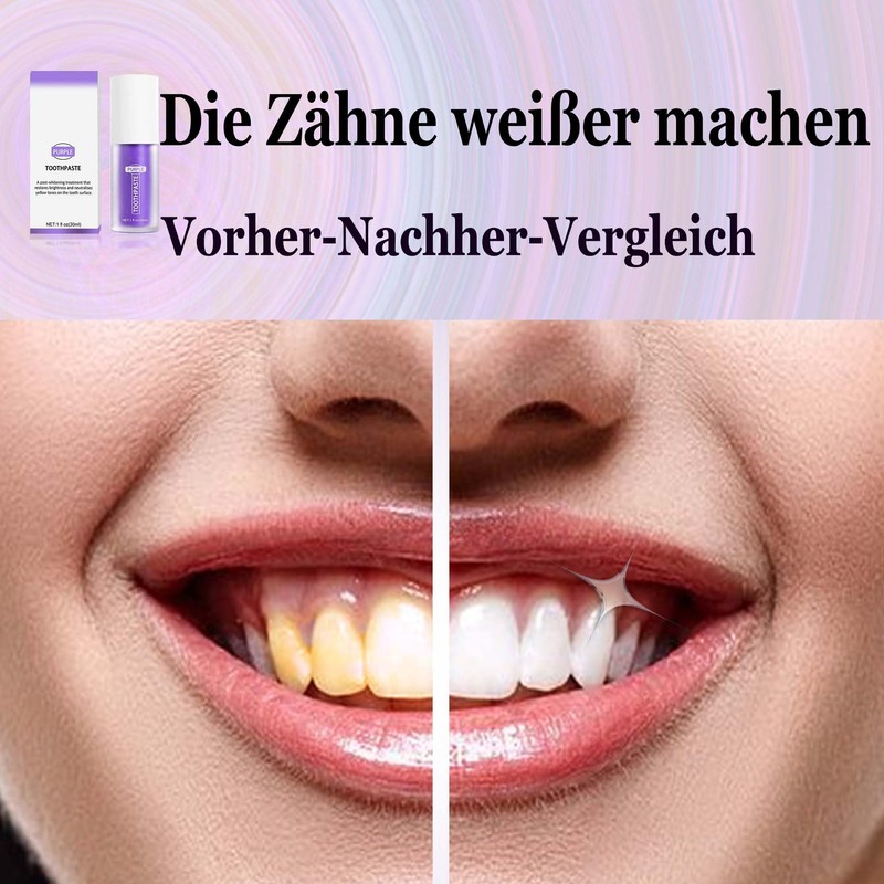 Lila Zahnpasta für Zahnaufhellung-Purple Toothpaste for teeth whitening-weiße zähne (1