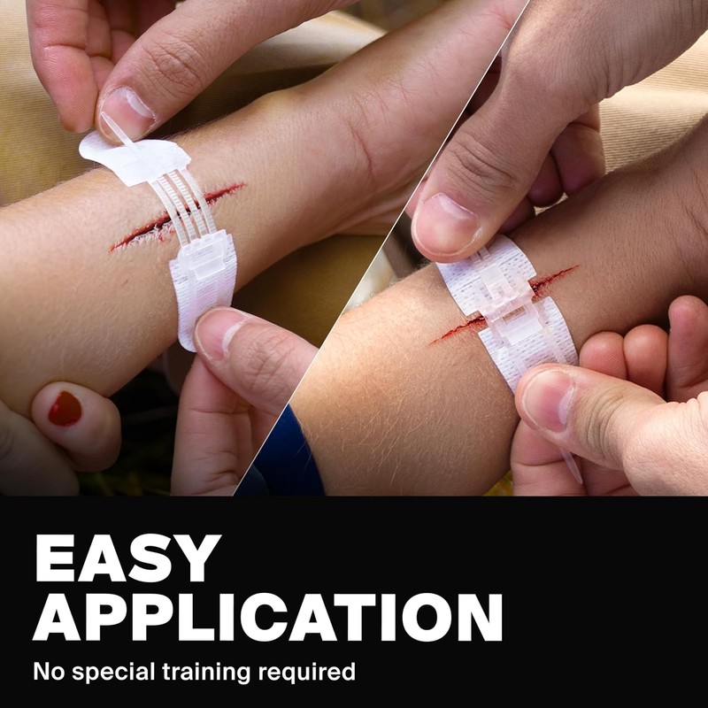 SurviveX Zip Stitch Wound Closure Strips - Repair Wounds Without