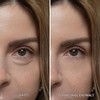 Dr.Melaxin Retinol Eyebag Cream for Puffiness, Dark Circles & Fine