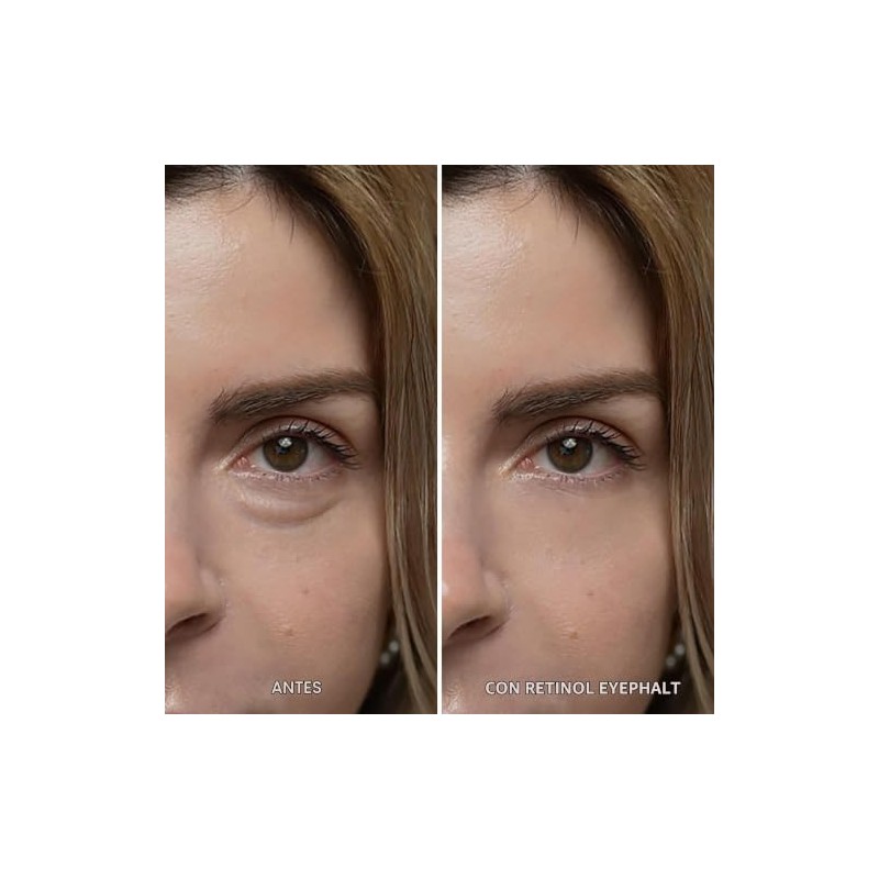 Dr.Melaxin Retinol Eyebag Cream for Puffiness, Dark Circles & Fine