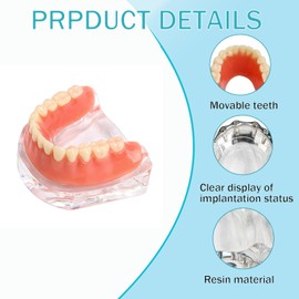 Kouyot Dental Model Overdenture Transparent Dental Implants Model Detachable Model Lower Jaw Dental Teaching Model Suitable for Education and Study Silver