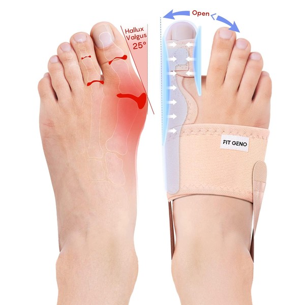 Fit Geno Bunion Corrector for Women Big Toe: Upgraded Orthopedic Bunyon Splint w/Brace - Comfortable Foot Straightener for Day/Night Hallux Valgus Pain Relief 2 Pcs