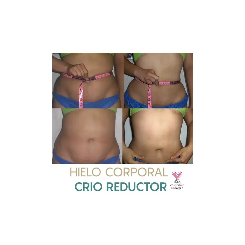 Hielos Reductivos Hieloterapia Kit 5 Hielos + Gel + Loción
