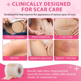 Silicone Scar Sheets,Silicone Scar Tape 1.6'' x 120'',Reusable Professional Silicone Scar Sheet for Surgical Scars,Tummy Tuck, Keloid, Burn, Acne,C-Section