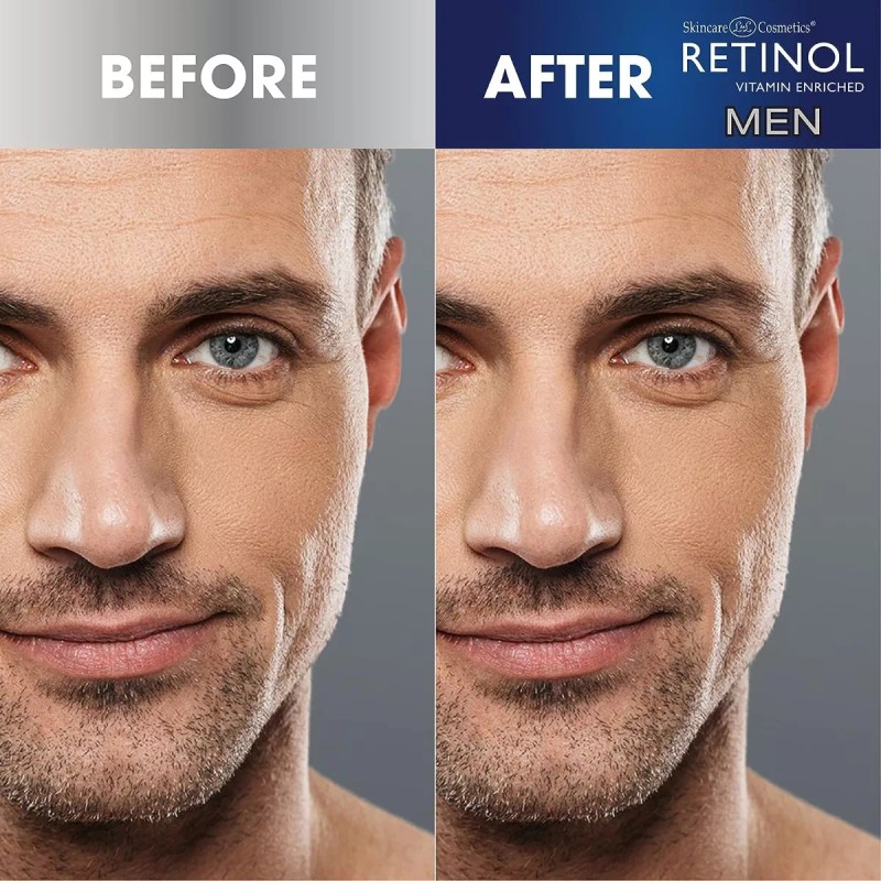 Retinol Serum Facial Antiarrugas Para Hombre, Antienvejecimi