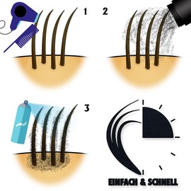 Hair Quicky® Premium Hair Fibres, Pouring Hair, Scattered Hair, Instant Effect on Secret Corners, Partial Bald, Hair Loss and Light Hair, for Men and Women, Natural Keratin, 100 g, Black