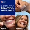 Crest 3D Whitestrips Age Renew – Teeth Whitening Kit, 21