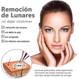 Plasma Pen, 10 niveles de intensidad, recargable, Con pantalla LED (Rosa)