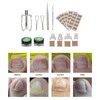 Ingrown Toenail Lifter Set Toenail Patch Sleeves Tweezers Stainless Steel
