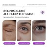 Bolsas Para Los Ojos Ojeras Crema Hidratante Para Ojos *q