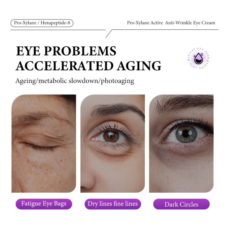 Bolsas Para Los Ojos Ojeras Crema Hidratante Para Ojos *q