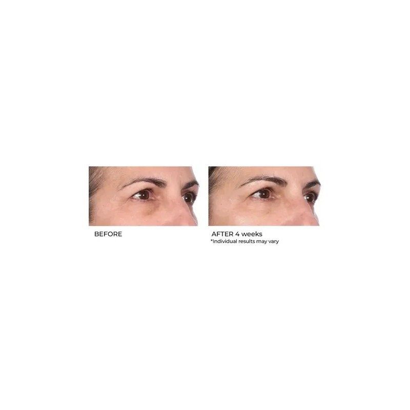 Suero De Biopéptido De Niacinamida Nassifmd Skincare