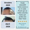 Kit Crecimiento Capilar Anticaida Hair Tonic + Shampoo
