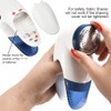 Sowind Fabric Shaver ， Lint Remover Fabric defuzzer Clothes Shaver