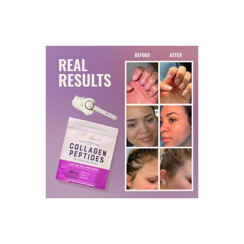 Live Conscious Péptidos Colágeno Polvo Hidrolizado Origen Natural Suplementos Tipo
