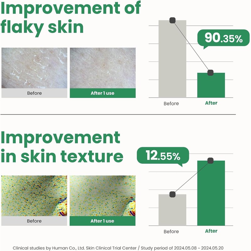 AXIS-Y - PHA Resurfacing Glow Peel - Exfoliante facial con