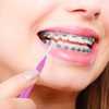 Healvian 100 Piezas Cepillos Interdentales PortáTiles Para Ortodoncias,Cepillos De Interdentales,Palillos