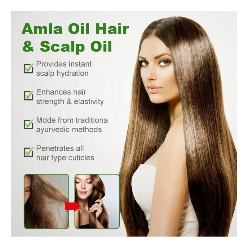 Mzl Aceite Capilar Amla Oil For Crecimiento Cabello