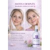 Agua De Rosas Tónico Facial Ácido Hialurónico Hidratante