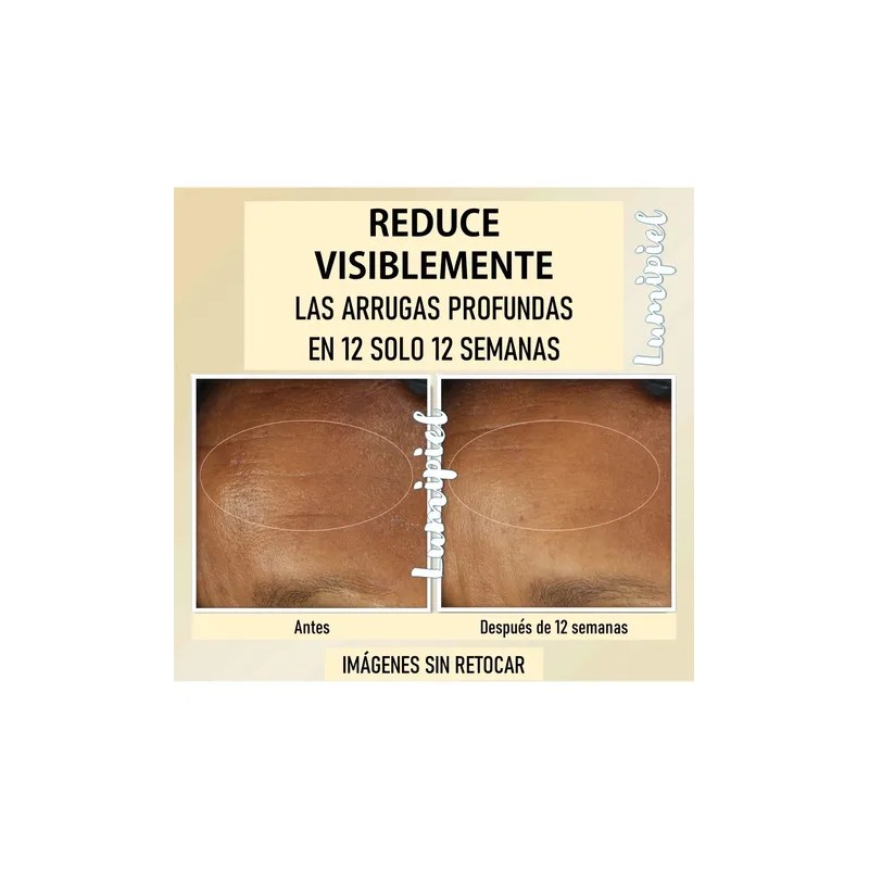 Roc Retinol Correxion Deep Wrinkle Crema Día Noche 2x30ml