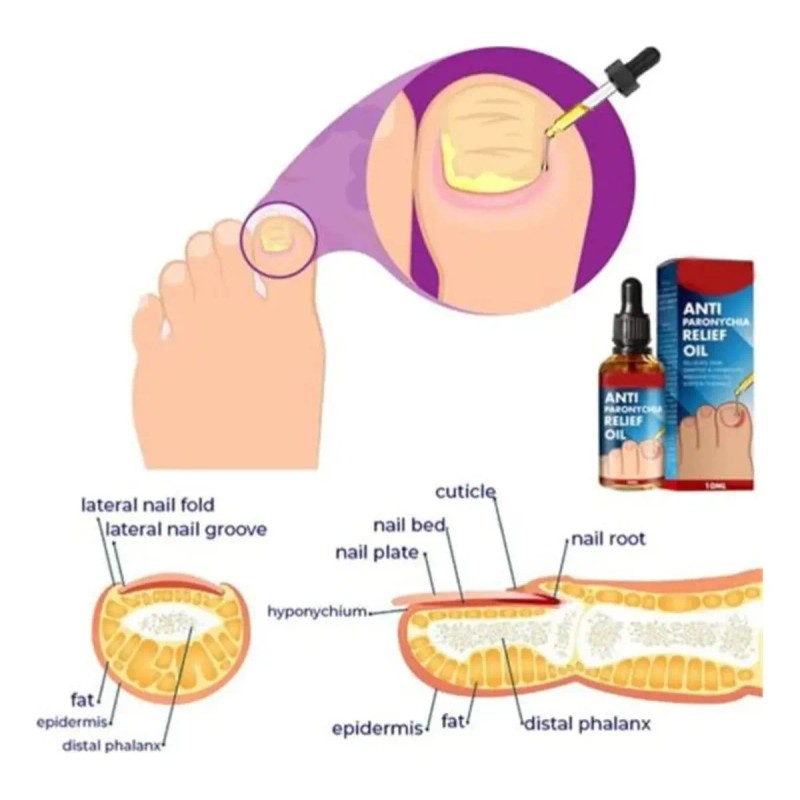 Tratamiento Reparador De Uñas De Pies Y Manos, Gotas De