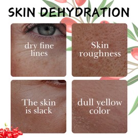 Goji Berry Facial Cream - Berry Anti Wrinkle Face Cream - Face Cream for Women - Revitalizing Face Moisturizer for Aging - Firming,Repairing,Dark Spot Removal Skin Tightening Crean 100ml