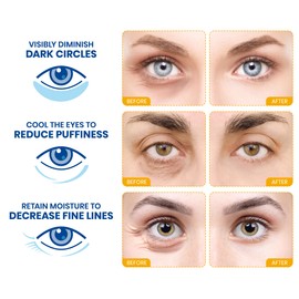 Stylia Under Eye Patches for Puffy Eyes and Dark Circles (20 Pairs) - 24k Gold Under Eye Mask with Vitamin C, Hyaluronic Acid, Pearl Extract - Eye Masks for Dark Circles and Puffiness